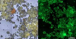 Zwei nebeneinander liegende mikroskopische Bilder zeigen auf der linken Seite Sedimentpartikel und auf der rechten Seite grün fluoreszierende Partikel unter UV-Licht.